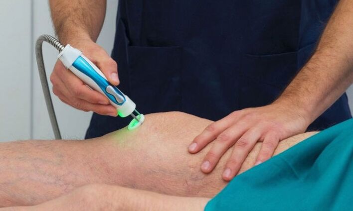 thermographie de l'articulation du genou avec arthrose